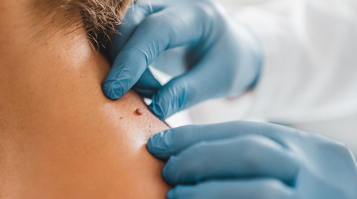 category-dermatology@2x